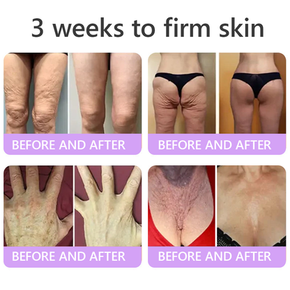 Limited-Time Offer⚡LIMETOW® PDRN Multi-Peptide Massaging Body Roller Cream- ✨𝐀𝐧𝐭𝐢-𝐚𝐠𝐢𝐧𝐠, Hydrating, Skin Firming & Lifting, Skin Repair, Even Tone, Acne and Dark Spot Treatment, Wart and Mole Removal, and Psoriasis Relief