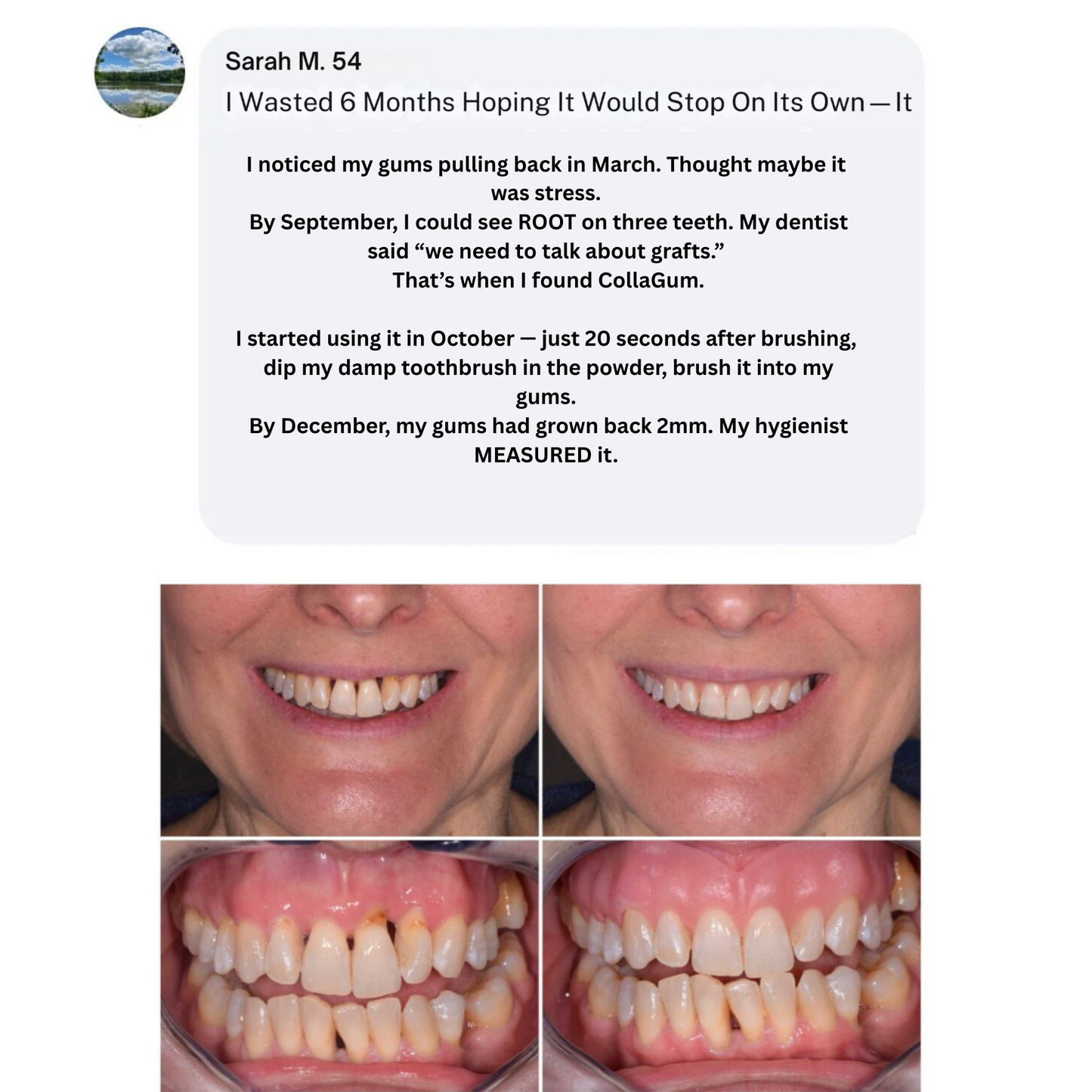 Collagum Smile Strengthening Collagen Powder