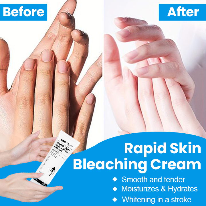 📢📢Last Day Discount🎈 LIMETOW™ Rapid Skin Bleaching Cream