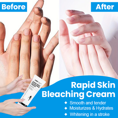 📢📢Last Day Discount🎈 LIMETOW™ Rapid Skin Bleaching Cream