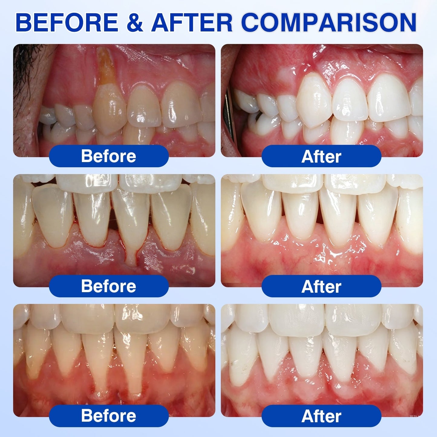 Gum Revive Periodontal Repair Gel