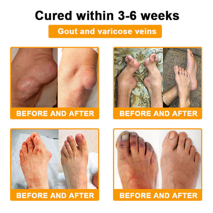 🎁Flash Sale - Botulinum Toxin & Bee Venom Pain-Relief Bone Healing Cream🐝💎