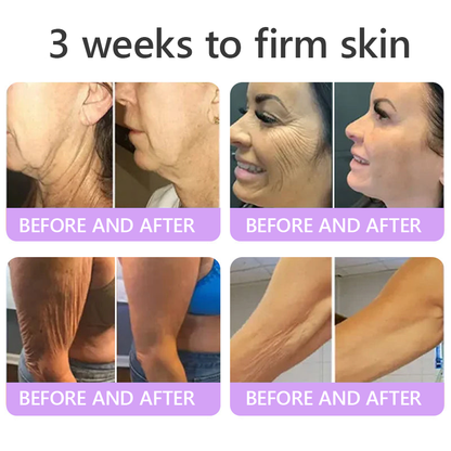 Limited-Time Offer⚡LIMETOW® PDRN Multi-Peptide Massaging Body Roller Cream- ✨𝐀𝐧𝐭𝐢-𝐚𝐠𝐢𝐧𝐠, Hydrating, Skin Firming & Lifting, Skin Repair, Even Tone, Acne and Dark Spot Treatment, Wart and Mole Removal, and Psoriasis Relief