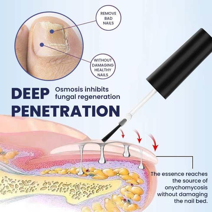 LIMETOW® Nail Repair Solution