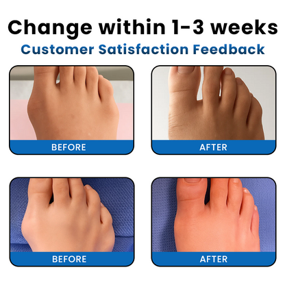 LIMETOW® Bunion-Free Solution