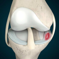 LIMETOW®Natural Knee Pain Patches image LIMETOW®Natural Knee Pain Patches