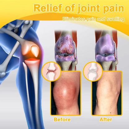 🎁Flash Sale - Botulinum Toxin & Bee Venom Pain-Relief Bone Healing Cream🐝💎