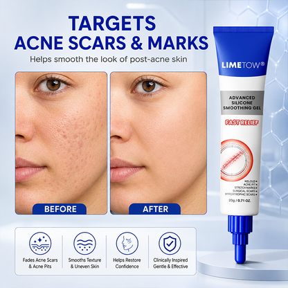 LIMETOW® Advanced Silicone Smoothing Gel