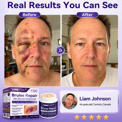 LIMETOW® Bruise Repair & Skin-Strengthening Cream