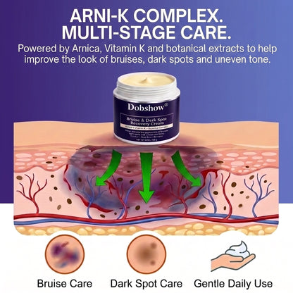 10K+ SOLD 🔥Dark Spot & Bruise Recovery Cream ✨  Helps Improve the Look of Dark Spots & Uneven Body Tone