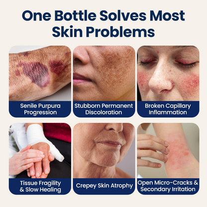 Bruise Appearance Barrier Care Cream