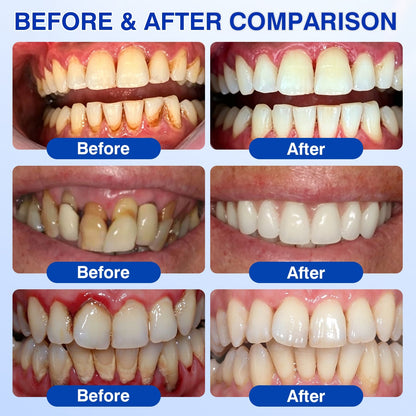 Gum Revive Periodontal Repair Gel