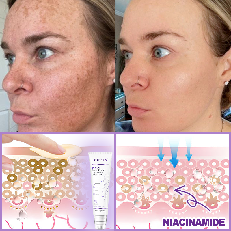 Limited-Time Offer⚡LIMETOW® PDRN Multi-Peptide Massaging Body Roller Cream- ✨𝐀𝐧𝐭𝐢-𝐚𝐠𝐢𝐧𝐠, Hydrating, Skin Firming & Lifting, Skin Repair, Even Tone, Acne and Dark Spot Treatment, Wart and Mole Removal, and Psoriasis Relief