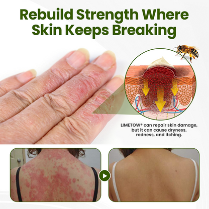 LIMETOW® Bee Peptide Soothing Cream