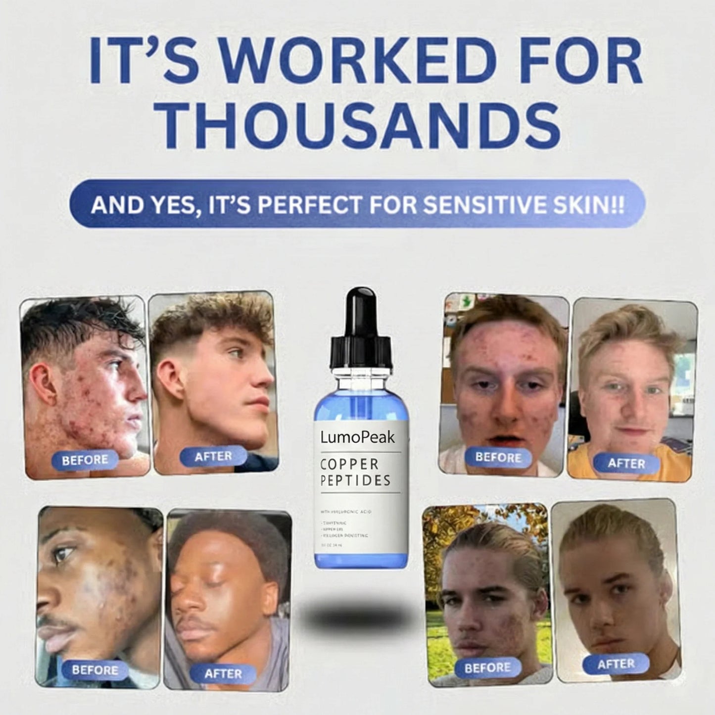 GHK-Cu Peptide Serum🌎Ends Today: 50% OFF!