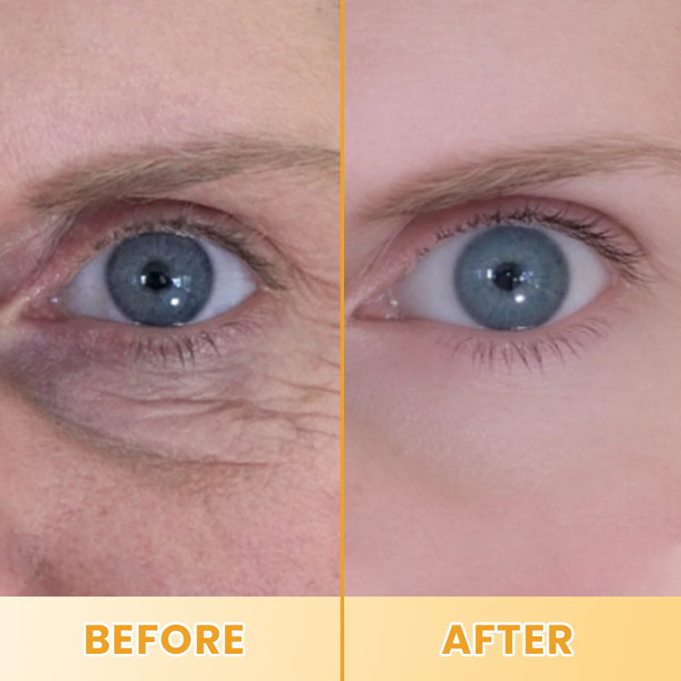 LIMETOW® Lutein Eye Essence Oil