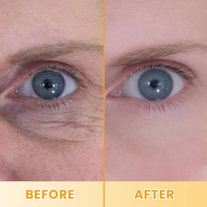LIMETOW® Lutein Eye Essence Oil
