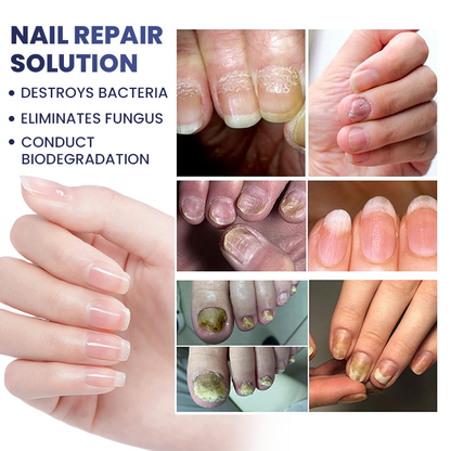 LIMETOW® Nail Repair Solution