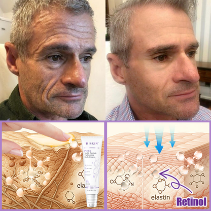 Limited-Time Offer⚡LIMETOW® PDRN Multi-Peptide Massaging Body Roller Cream- ✨𝐀𝐧𝐭𝐢-𝐚𝐠𝐢𝐧𝐠, Hydrating, Skin Firming & Lifting, Skin Repair, Even Tone, Acne and Dark Spot Treatment, Wart and Mole Removal, and Psoriasis Relief