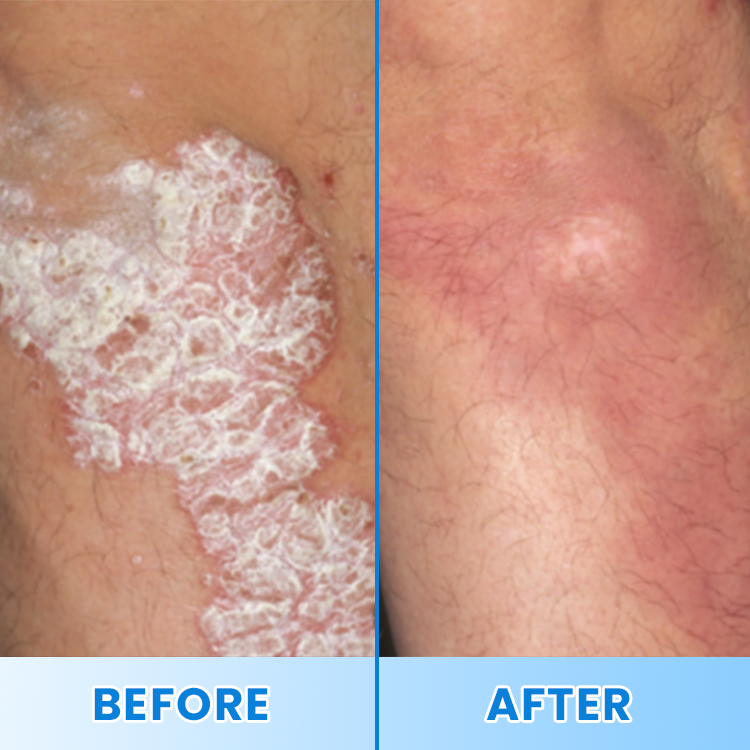 LIMETOW® Magnesium Herbal Soothing Spray