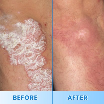 LIMETOW® Magnesium Herbal Soothing Spray