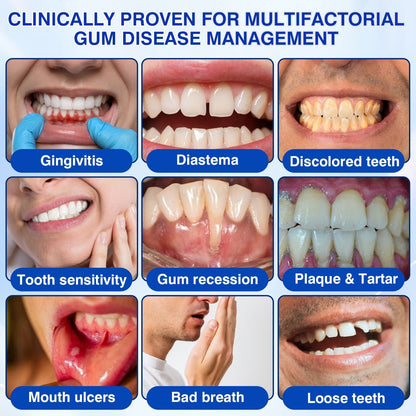 Gum Revive Periodontal Repair Gel