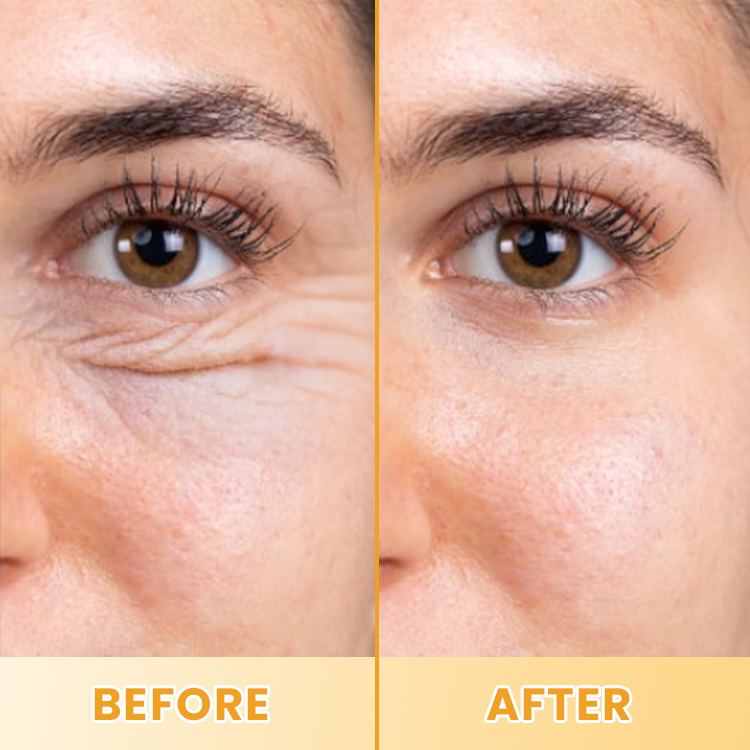 LIMETOW® Lutein Eye Essence Oil