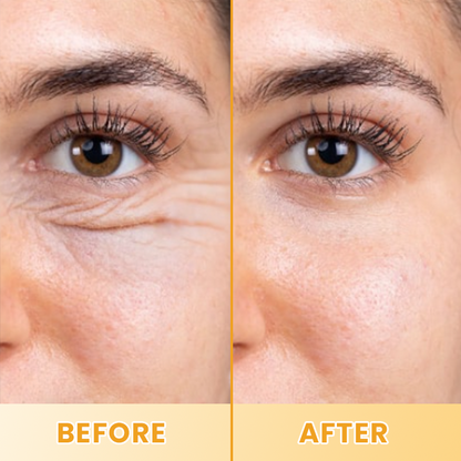 LIMETOW® Lutein Eye Essence Oil