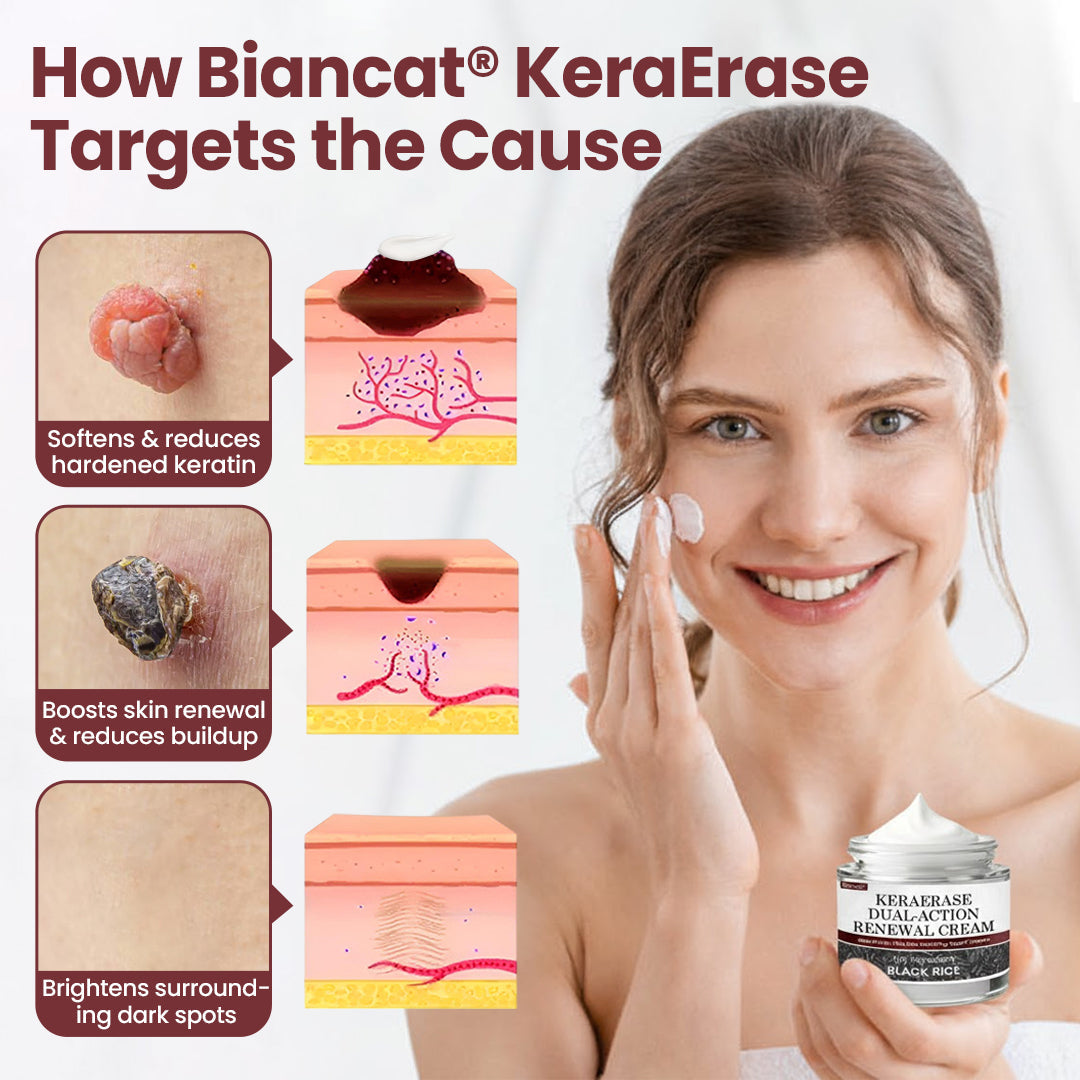 KeraErase Dual-Action Renewal Cream💎