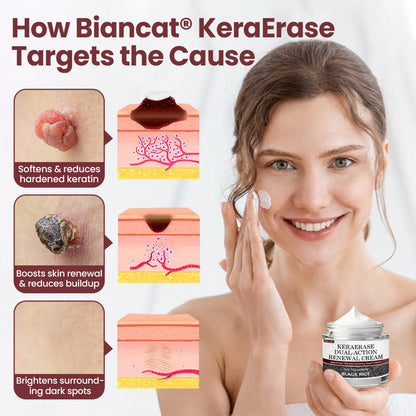 KeraErase Dual-Action Renewal Cream💎