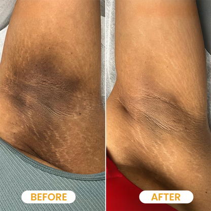 LIMETOW® Turmeric Exfoliating Body Scrub
