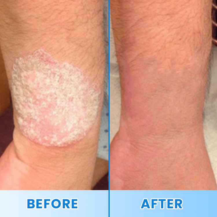 LIMETOW® Magnesium Herbal Soothing Spray