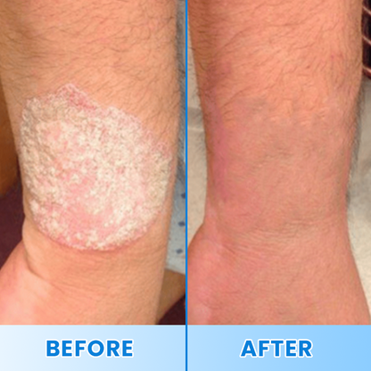 LIMETOW® Magnesium Herbal Soothing Spray