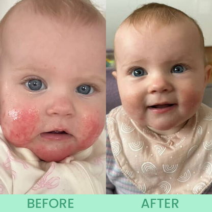 LIMETOW® Calm Balm