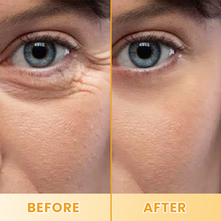 LIMETOW® Lutein Eye Essence Oil