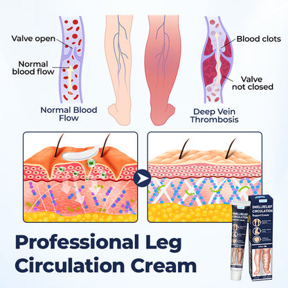 Swell Relief Circulation Support Cream🎁2026 Best Seller