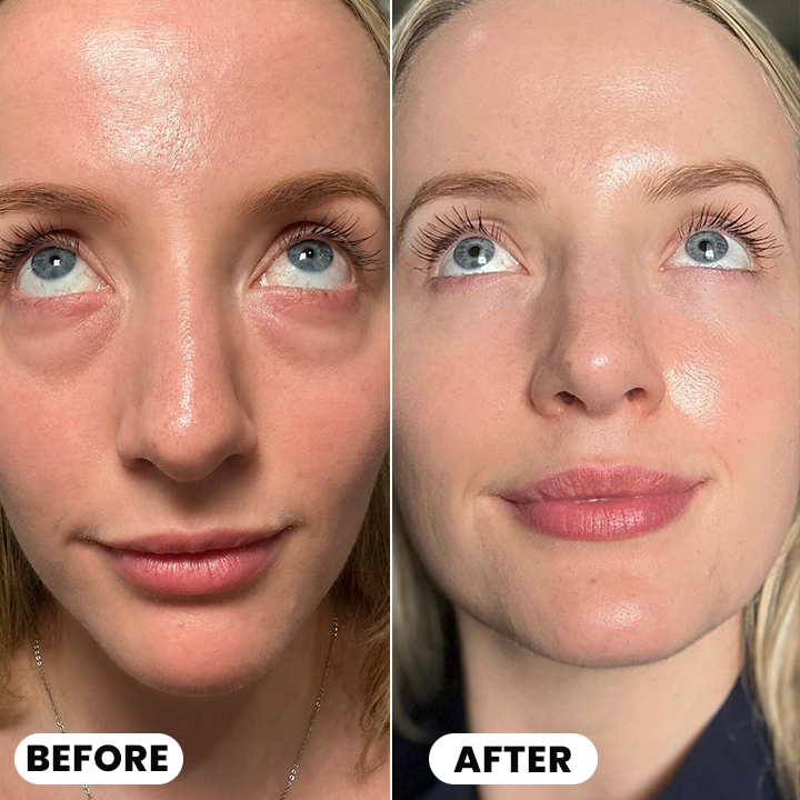 LIMETOW® Ultimate Depuff Eye Serum⚡Limited-Time Offer