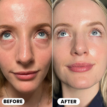 LIMETOW® Ultimate Depuff Eye Serum⚡Limited-Time Offer
