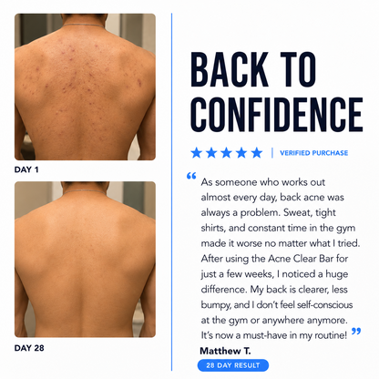 Back Acne Bar
