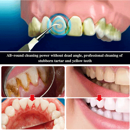 Whitening Teeth Cleaner