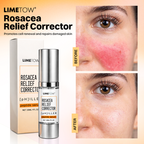 LIMETOW® Rosacea Relief Corrector