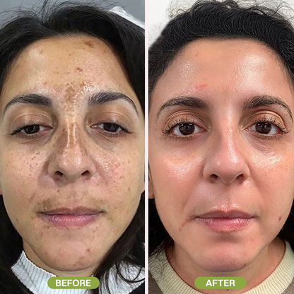 LIMETOW® Retinal Skin Booster Serum