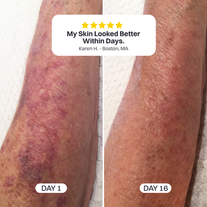 💥200K+ SOLD💕- LIMETOW® Bruise Repair & Skin-Strengthening Cream