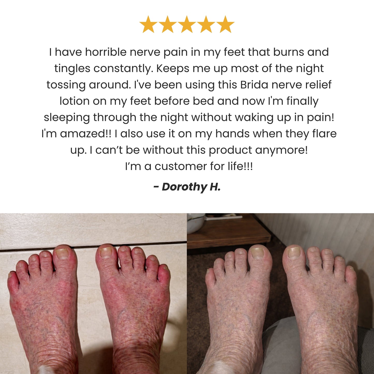Nerve Relief Lotion