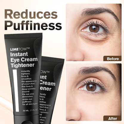 📢📢Last Day Discount🎈 LIMETOW™  Instant Eye Cream tightener