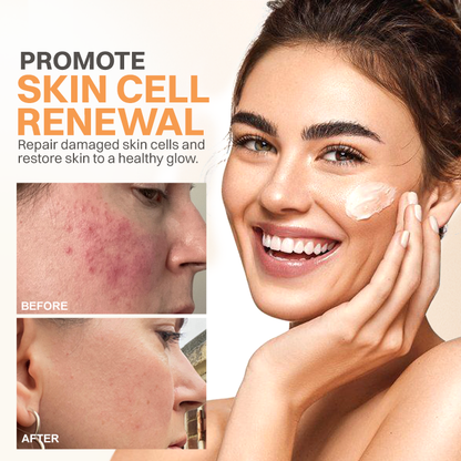 LIMETOW® Rosacea Relief Corrector