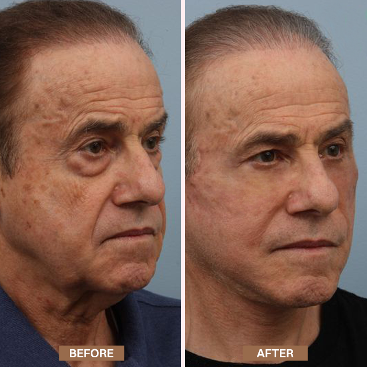 Limited-Time Offer⚡LIMETOW® Enhanse Under Eye Gel