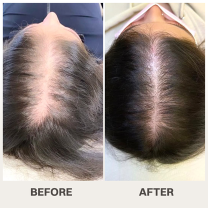 LIMETOW® Scalpy Hair Serum — The Scalp-First Hair Growth Breakthrough