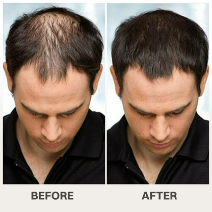 LIMETOW® Scalpy Hair Serum — The Scalp-First Hair Growth Breakthrough