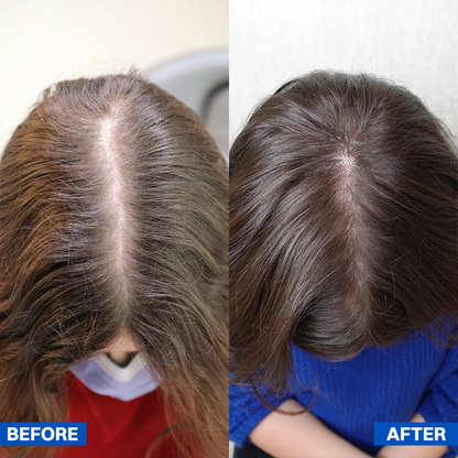 LIMETOW® Scalpy Hair Serum — The Scalp-First Hair Growth Breakthrough
